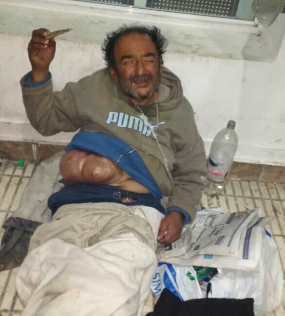Tiene una hernia abdominal y le niegan la atención médica  porque es indigente