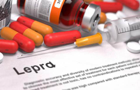 Campaña de prevención de Lepra en el hospital San Bernardo
