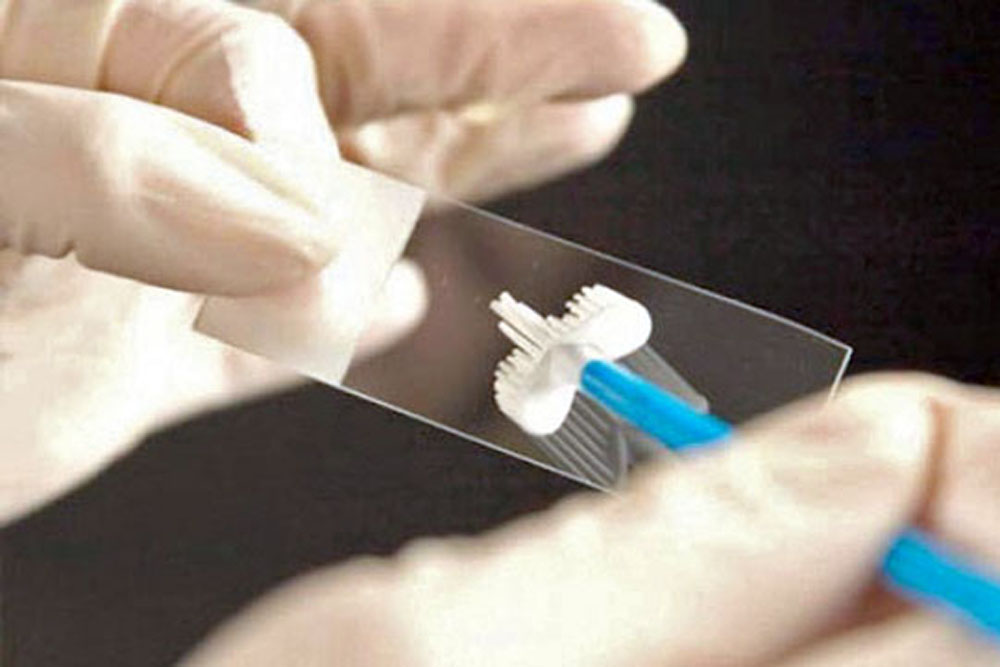 Realizarán estudios Papanicolau sin turnos previos  en el Hospital San Bernardo