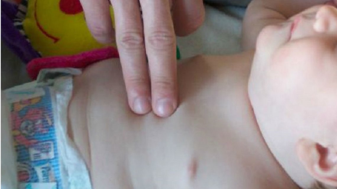 Cuando todo parecía perdido, una mujer salvó a un bebé con maniobras de reanimación