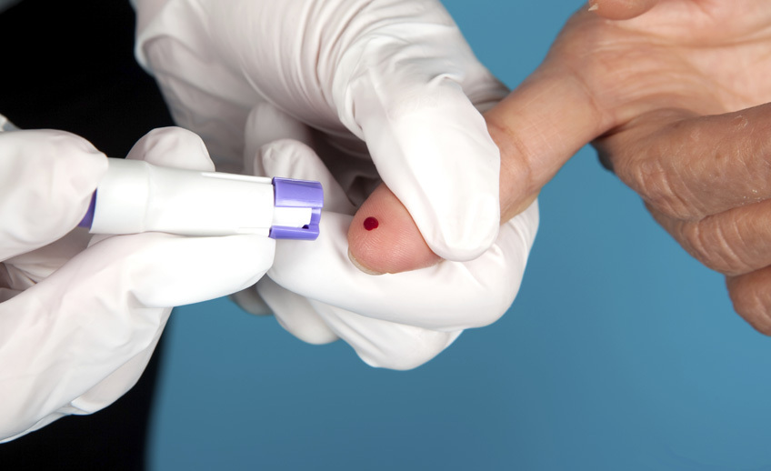 Realizarán test para detección de VIH en el barrio 20 de Febrero