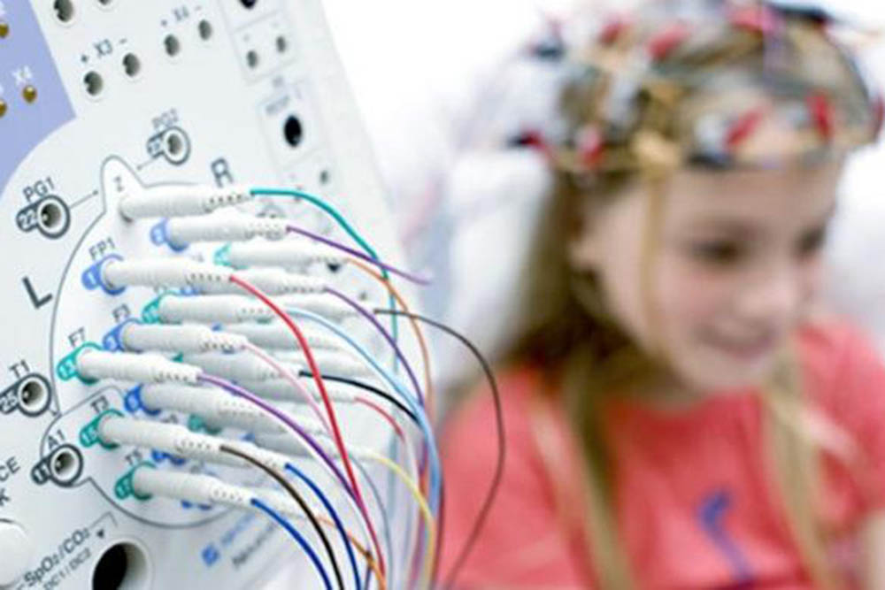 Pacientes con epilepsia serán atendidos en el Hospital Público Materno Infantil