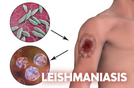 Las leishmaniasis son enfermedades endémicas que afectan al noroeste argentino