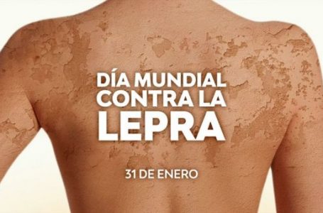 El 31 de enero se celebra el Día Mundial contra la Lepra