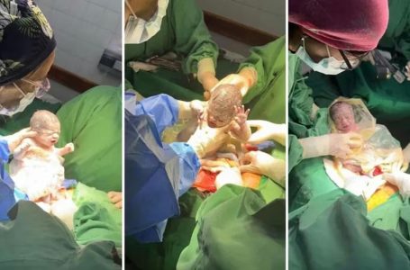 Nacieron trigemelas en Salta: un parto que ocurre uno en un millón