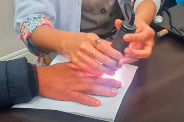 El hospital Señor del Milagro realizará una charla abierta sobre la esclerodermia